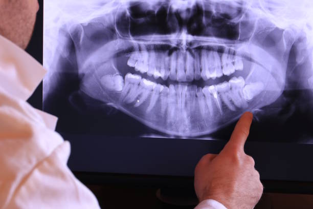 Best Pediatric Emergency Dentist in Eureka, IL